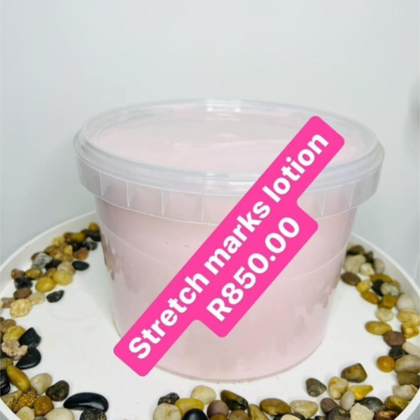 Stretch Mark Lotion 5kg