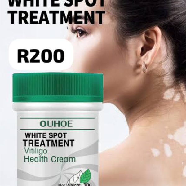 White Spots Treatment