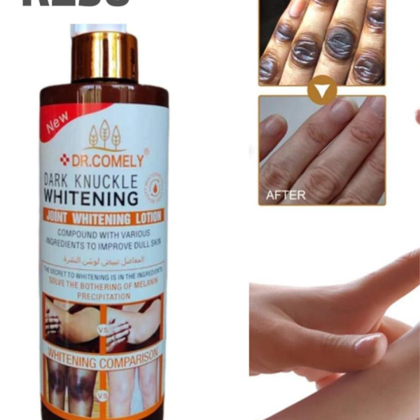 Dark Knuckle Whitening